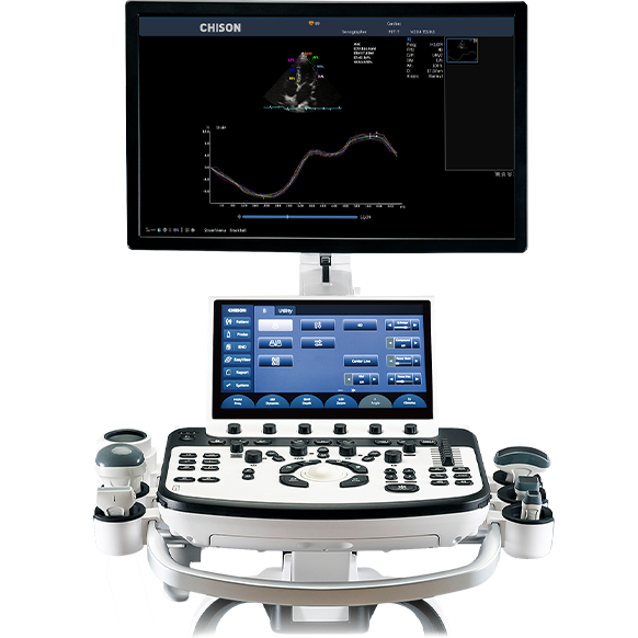 ELCOM Chison XBit 90 Doppler